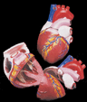 Thumbnail of Jumbo Heart | Click to see enlarged image